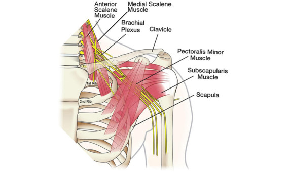 Muscle-pain-brachial-plexus-wrist-pain-neck-cervical-14150-14221-Buffalo-Chiropractor-rotator-cuff-shoulder-carpal-tunnel-Herrington-Family-Chiropractic-slider