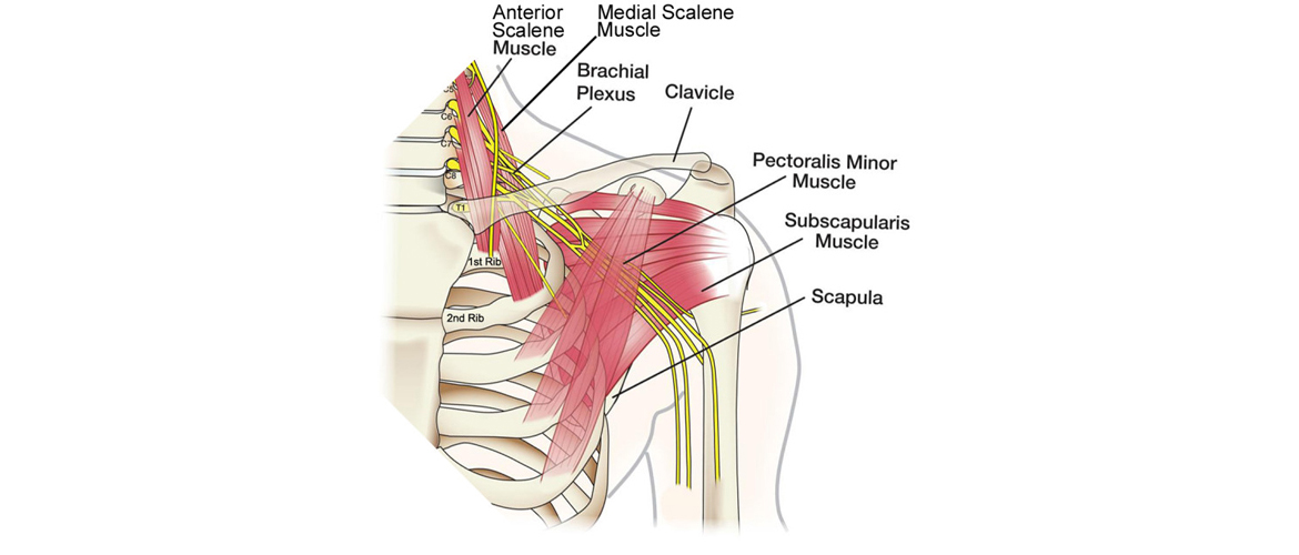 Muscle-pain-brachial-plexus-wrist-pain-neck-cervical-14150-14221-Buffalo-Chiropractor-rotator-cuff-shoulder-carpal-tunnel-Herrington-Family-Chiropractic-slider